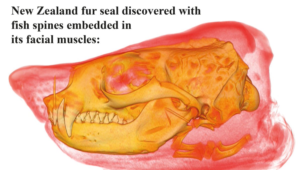 In our paper, we describe an unlucky fur seal found dead in southeastern Australia.CT scanning revealed 6 fish spines embedded in the soft tissue around its face, and 10 stiletto-style stab wounds to its cheeks and throat - likely from spines that didn't stick!