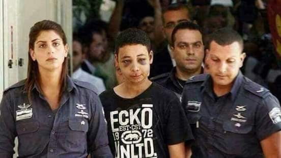 GhulamM48154266's tweet photo. Palestinian child prisoner Tariq Abu Khudair during his presentation to the court with signs of torture appearing on his face. If this child was in any other country, all the organizations that claim human rights and children would have talked about him and his rights. https://t.co/1etjuqt5Mr