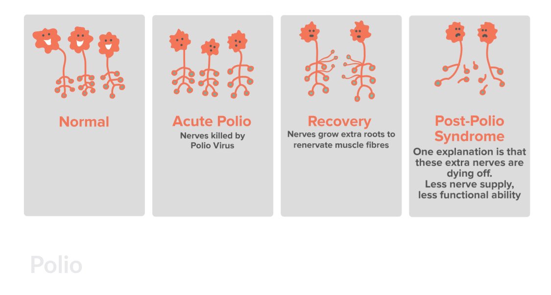 6/ People infected with  #polio could also go on to develop “post-polio syndrome” or polio-related symptoms with onset occurring anytime from around 10 years to more than 60 years after initial infection, related to the damage the poliovirus did to the  #neurons.