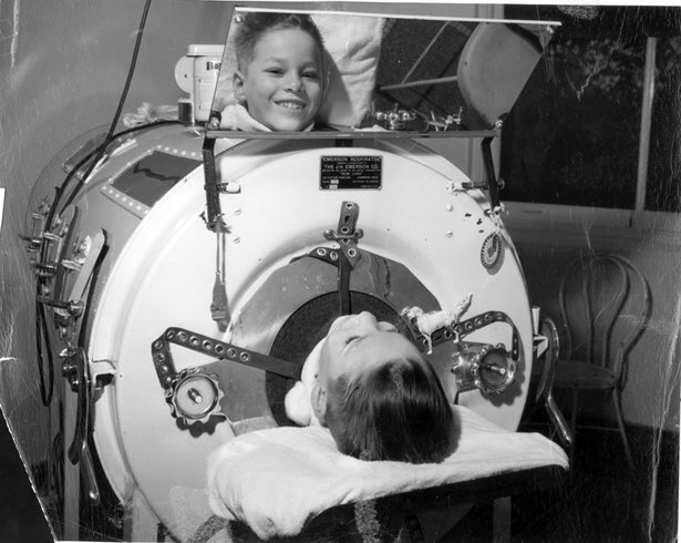 2/ About 1-2% of people had severe muscle pain, and stiffness in the neck and back. <1% of cases resulted in  #paralysis including the legs and the nerves controlling breathing and swallowing necessitating use of the iron lung  #ventilators.  #Polio could attack the  #CNS.