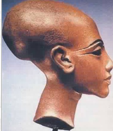 La déformation du crâne semble être un héritage de la civilisation négroafricaine d’Égypte antique, qui semble avoir joué un rôle clé. En effet, la reine Néfertiti est souvent représentée avec un crâne allongé, tout comme le roi Toutankhamon.