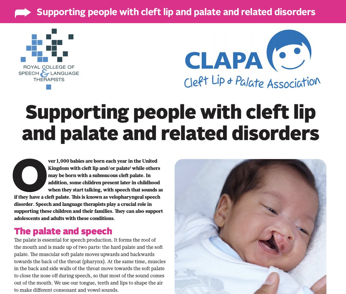 RCSLTpolicy's tweet photo. .@RCSLT's #cleft lip & #palate factsheet happened because of one person. Inspired by @JenMurphySLT's #respiratorySLT factsheet, @stephmck1971 approached us about a #CleftSLT factsheet. Steph wrote it & helped us every step of the way. Huge thanks, Steph! https://t.co/InJitsyK2i https://t.co/IprKwYNQCo
