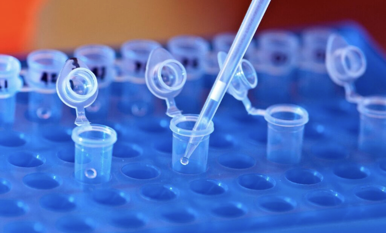 ExpreS2ionB's tweet photo. The #ExpreS2 system enables your VLP/ recombinant #antigen #expression & process development. Contact info@expreS2ionbio.com #biotech #drosophila #S2 #vaccines #vaccineswork #complexproteins #zika #malaria #dengue #hpv #her2 #hiv #tlr7 #tlr8 #tlr4 #human #research #mhc2 https://t.co/ASuVPB92VQ