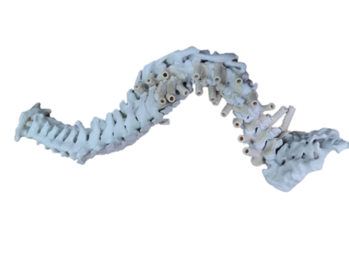 3dheals's tweet photo. Just published! #ExpertCorner blog on #PointofCare w #3DPrinting in #India by @Anatomiz3D co-founder Firoza Kothari @Firozakothari https://t.co/c2jqlSXw7u https://t.co/1ot0l7ckmH