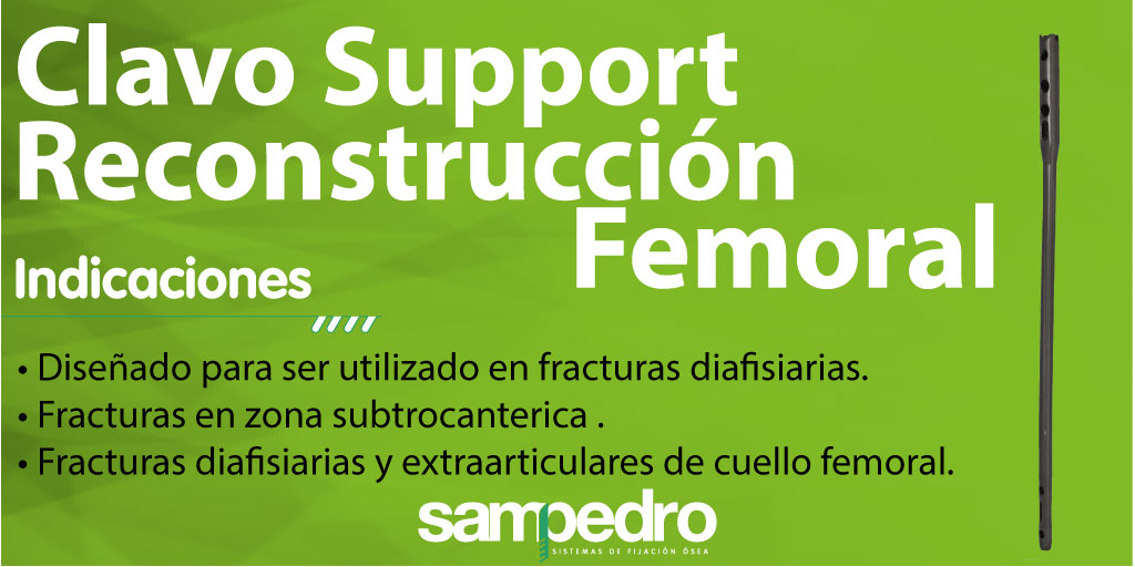 Este es nuestro nuevo Clavo Support Reconstrucción Femoral, conoce sus indicaciones y descripción.
