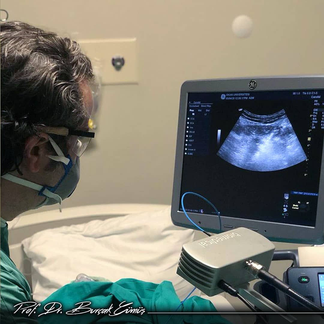 Güne karaciğere yayılım göstermiş kanser lezyonunu yeni teknoloji Mikrodalga ile tedavi ederek başladık...

Today’s first case is the Microwave ablation of a liver metastatic cancer...

#girişimselradyoloji #microwaveablation #karacigerkanseri
#livercancer #kanser #metastatic