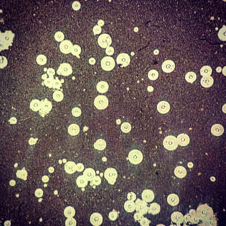 mICROBIOsh's tweet image. Test de tinta china: positivo 

Se observan Levaduras encapsuladas digestivas de #Cryptococcus spp.