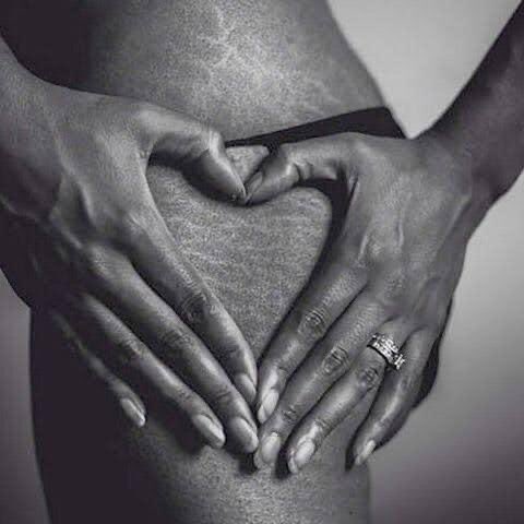 eman70113623's tweet photo. YOUR BODY IS NOT RUINED.
Those lines on your thighs are poetry, and the stretching of your skin tells a story of a strong beautiful woman.
Forget your #Stretch_marks
you are beautiful 💜💜 https://t.co/aGm3YUN7Je