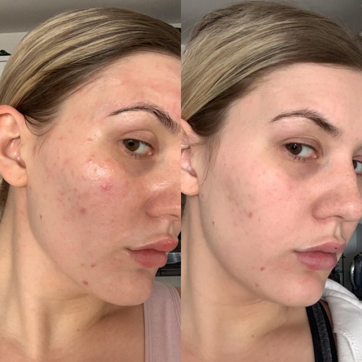 zo skin health results