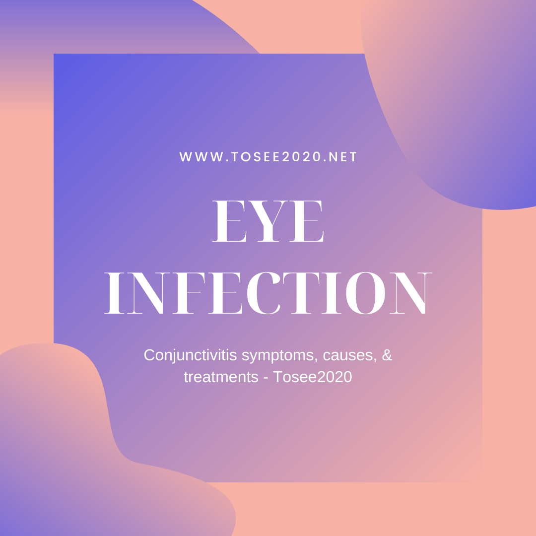 tosee2020's tweet image. Conjunctivitis symptoms, causes, &amp;amp; treatments - Tosee2020
#optometristservices #tosee2020 #VisionCentreWalmart #Dr_Toseef_Hasan #Dr_Jency_Elakatt  #VisionCenter #EyeDr #FamilyEyeCare 
#optometristserviceproviderinAddison
Visit : bit.ly/2SAnVrZ