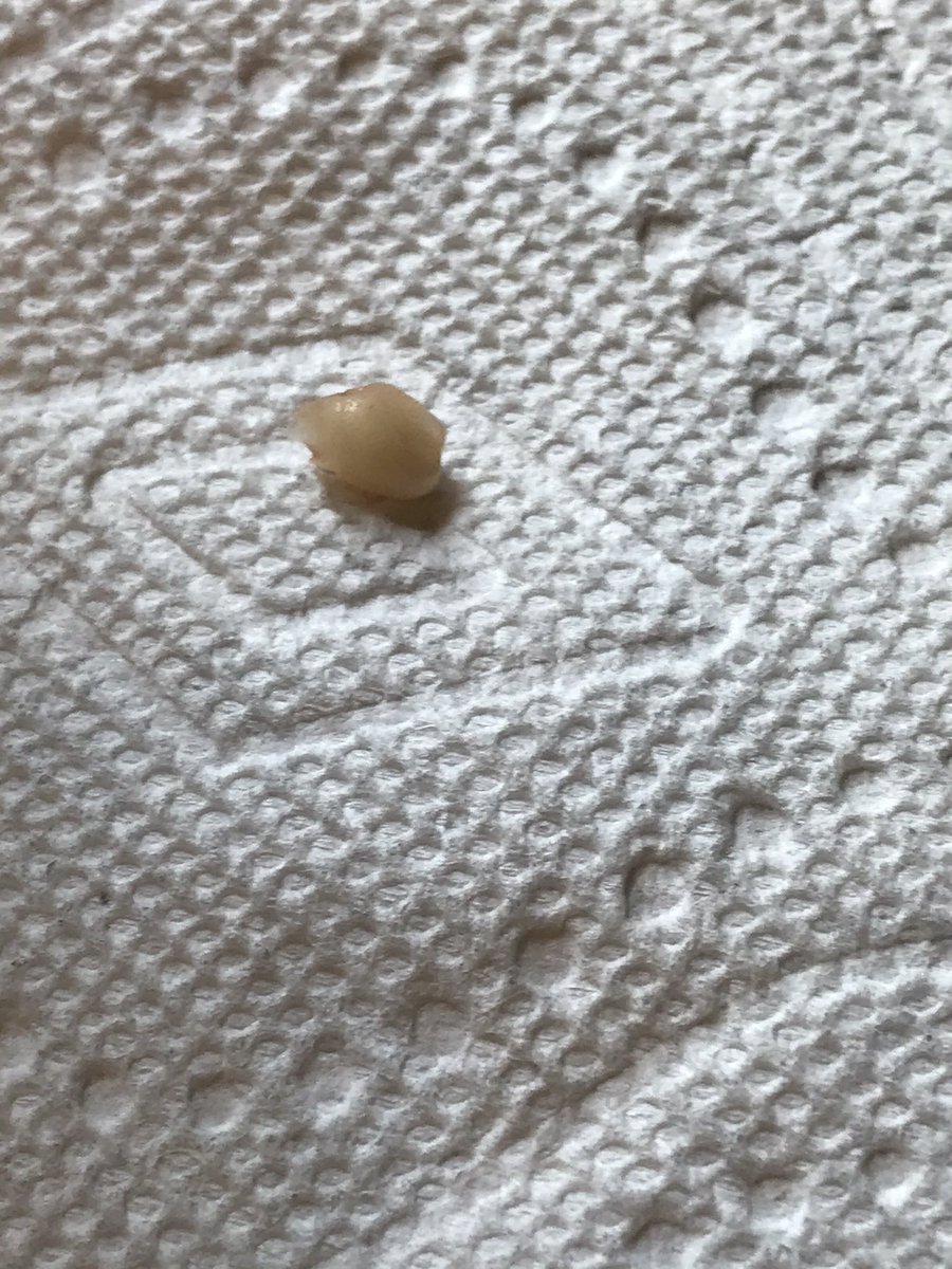 CristinGoodwin's tweet image. Frankly, I think his math teacher handled this well during the Teams call.  Especially once the blood stopped.  #LostTooth