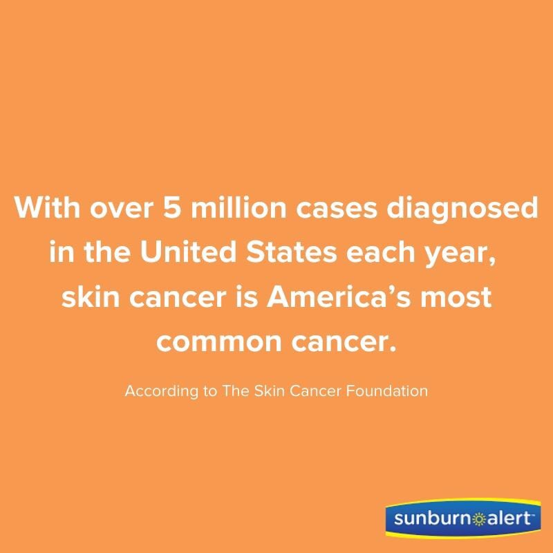 Sunburn Alert tweet media