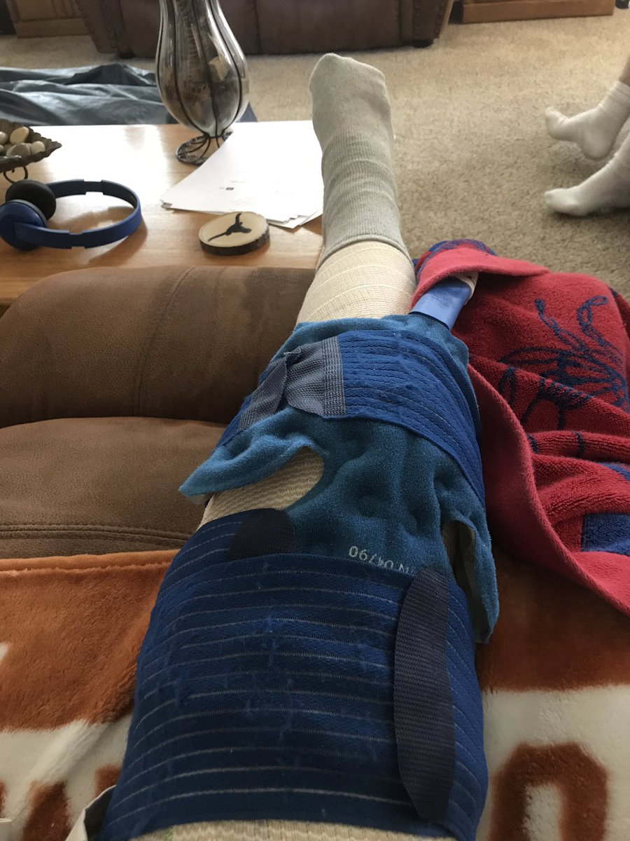 SAhlgrimm's tweet photo. Well I figured since I can’t do anything else I might as well have knee surgery. 😂 Actually was scheduled for meniscectomy in March before it got cancelled due to covid 19. https://t.co/otsWBSMenN