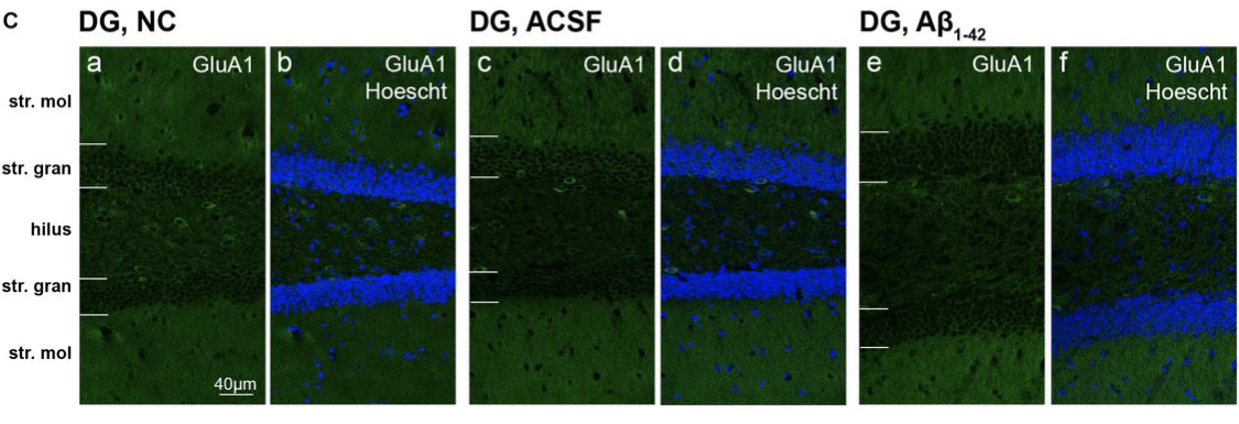 ANS_Students's tweet photo. Check out this paper by #ansstudent Jason Yeung from @AucklandUni! The Acute Effects of Amyloid-Beta1โ42 on Glutamatergic Receptor and Transporter Expression in the Mouse Hippocampus in @FrontNeurosci (1/3) https://t.co/88Ca56mwiF