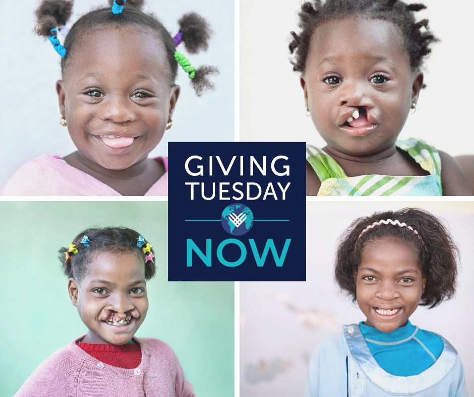 OpSmileSA's tweet photo. As an emergency response to the worldwide need caused by COVID-19, #GivingTuesdayNow is a global day of giving and awareness. Our focus remains the well-being of all our patients. Your donation, will help make a difference. Become a #SmilePartner > https://t.co/kWToIeQNUR https://t.co/pHWjl763Sg
