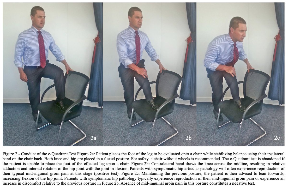 Brad_Beer's tweet photo. [PICKING UP SYMPTOMATIC HIP PATHOLOGY VIA TELEHEALTH] This e-quadrant test’s sensitivity was found to be 87% w a specificity of 79% and overall accuracy of 82% for articular hip pathology. It’s been handy w online sessions I have done w runners (Weinrauch et al, 2015) ✅ #physio https://t.co/iB2UAReXja