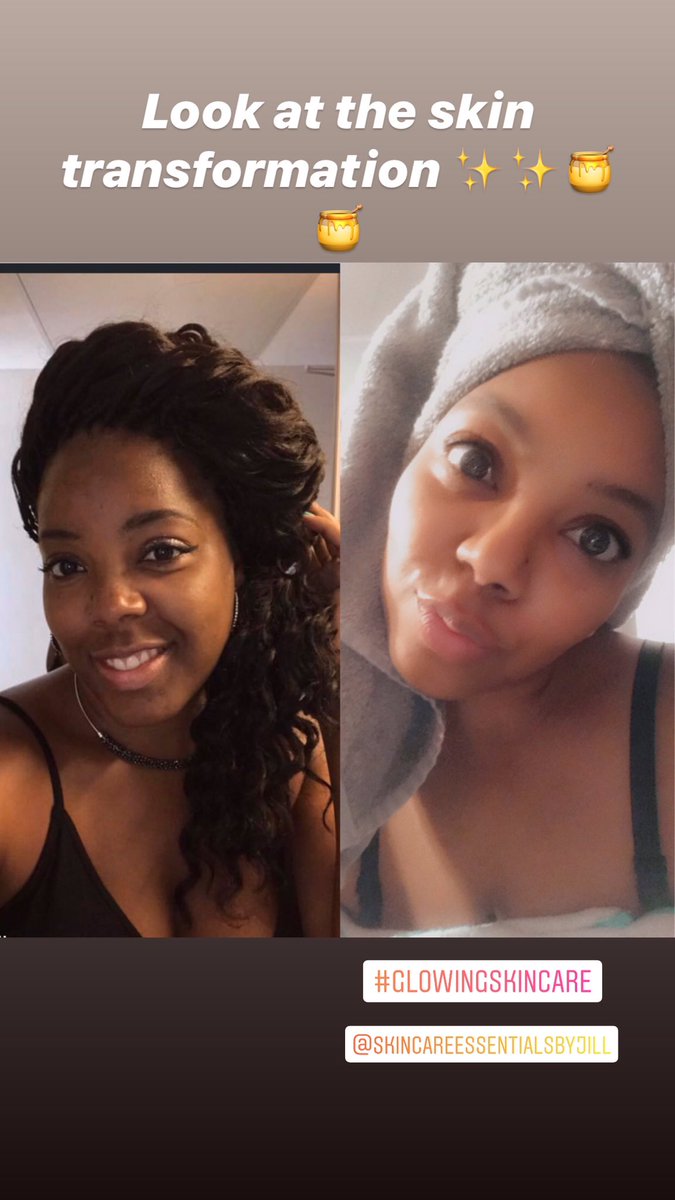 Therealwithjill's tweet photo. #skincare #skin #acne #darkspots #oilyskin #cleanskin #HealthySkin #BlackWomen https://t.co/WnrF8bDAmx