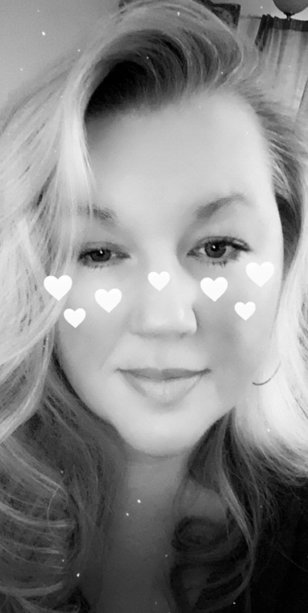 Strangest case of acne I've ever seen...