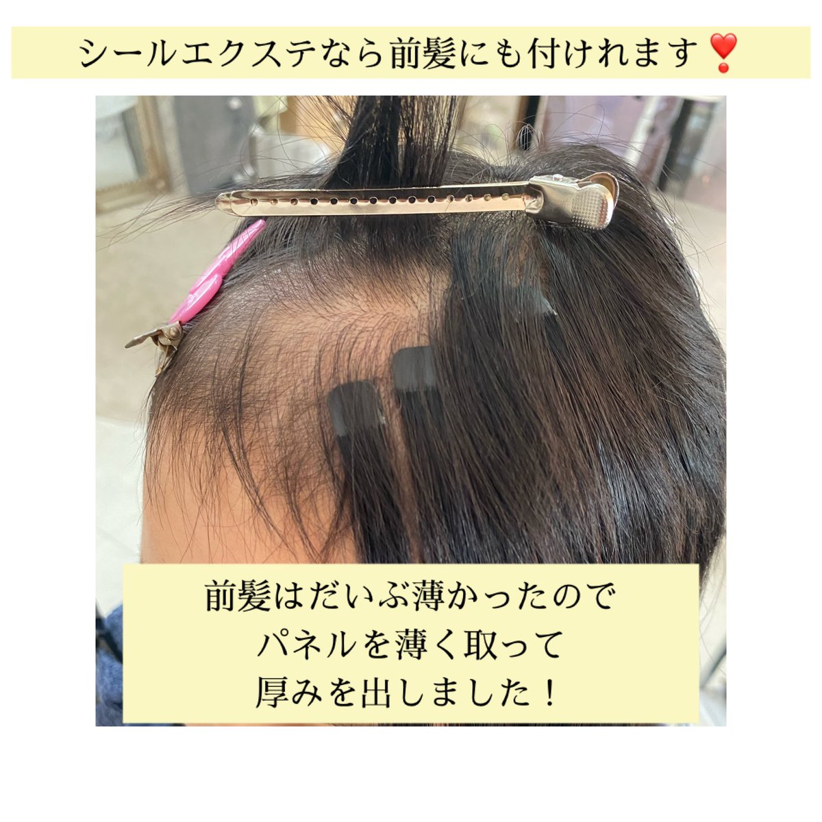 最大の 偽 通訳 抗 が ん 剤 前髪 エクステ 効率的 パイロット ソーダ水