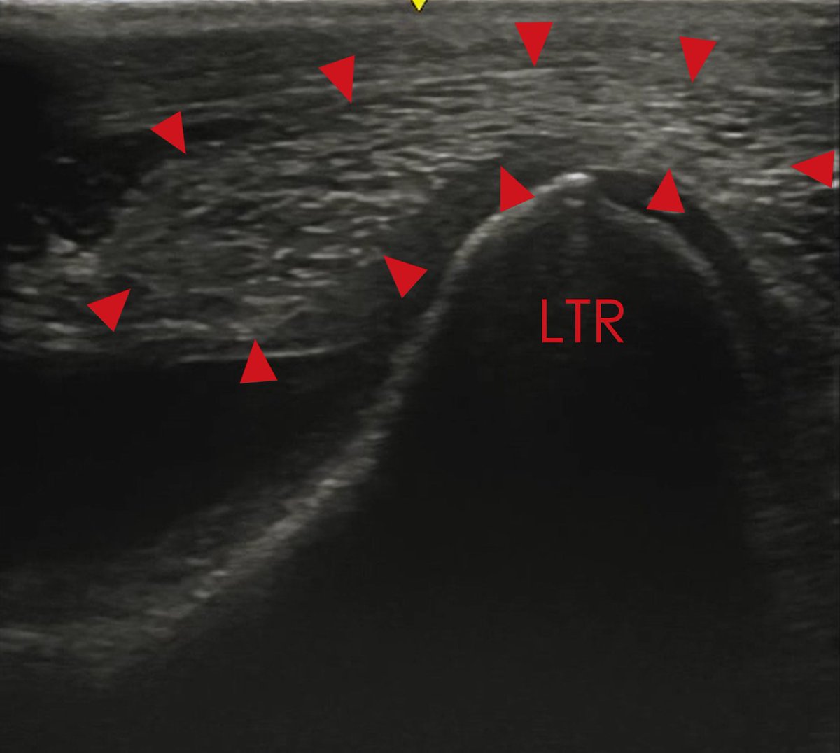 IMVimaging's tweet photo. Check out part 3 of our 4 part ultrasonography of the stifle series: cranial, medial and lateral approaches. #equine #vetblog #vets https://t.co/vER0WPeuWw https://t.co/EwYKpKwzzX