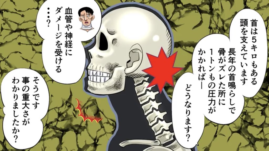 首をコキっと鳴らしたら半身不随になりかけた話 そ こ に あ る べ き 左 脚 が な い Togetter 首をコキっと鳴らしたら半身不随になりかけた話 そ こ に あ る べ き 左 脚 が な い Togetter