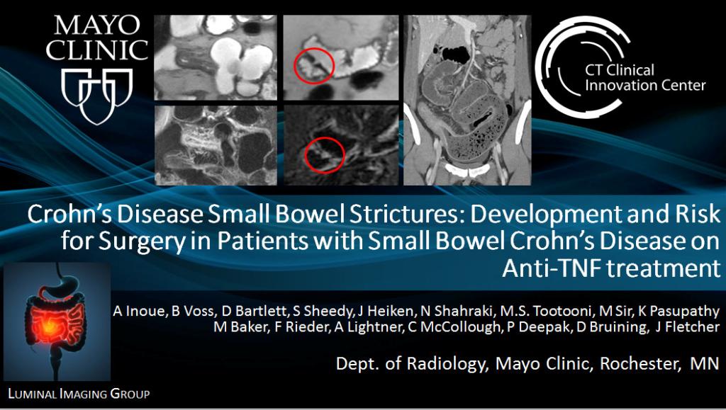 Mayo Clinic Gastroenterology & Hepatology on Twitter "Crohn’s Disease