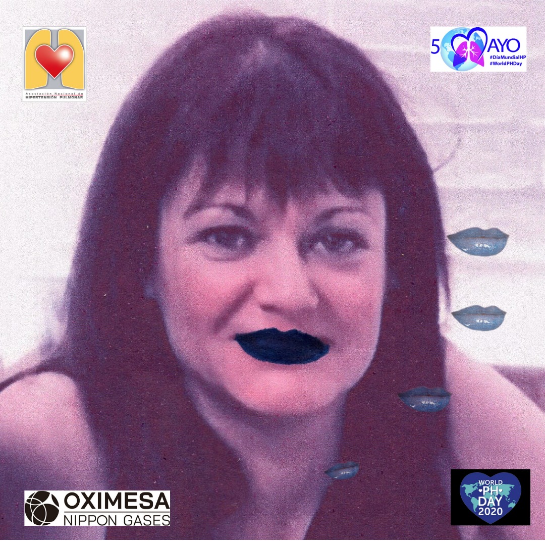 ANdHP's tweet photo. #DMHipertensionPulmonar ¿ cómo puedes colaborar para hacer está enfermedad más visible? Pues píntate los labios de azul y sube la foto. Contamos contigo! #WorldPHDay #WorldPHDay2020 #LabiosAzules #bluelips #pheurope @OximesaNG https://t.co/KeRFqgxY3H