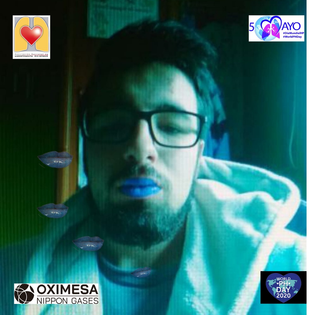 ANdHP's tweet photo. #DMHipertensionPulmonar ¿ cómo puedes colaborar para hacer está enfermedad más visible? Pues píntate los labios de azul y sube la foto. Contamos contigo! #WorldPHDay #WorldPHDay2020 #LabiosAzules #bluelips #pheurope @OximesaNG https://t.co/KeRFqgxY3H
