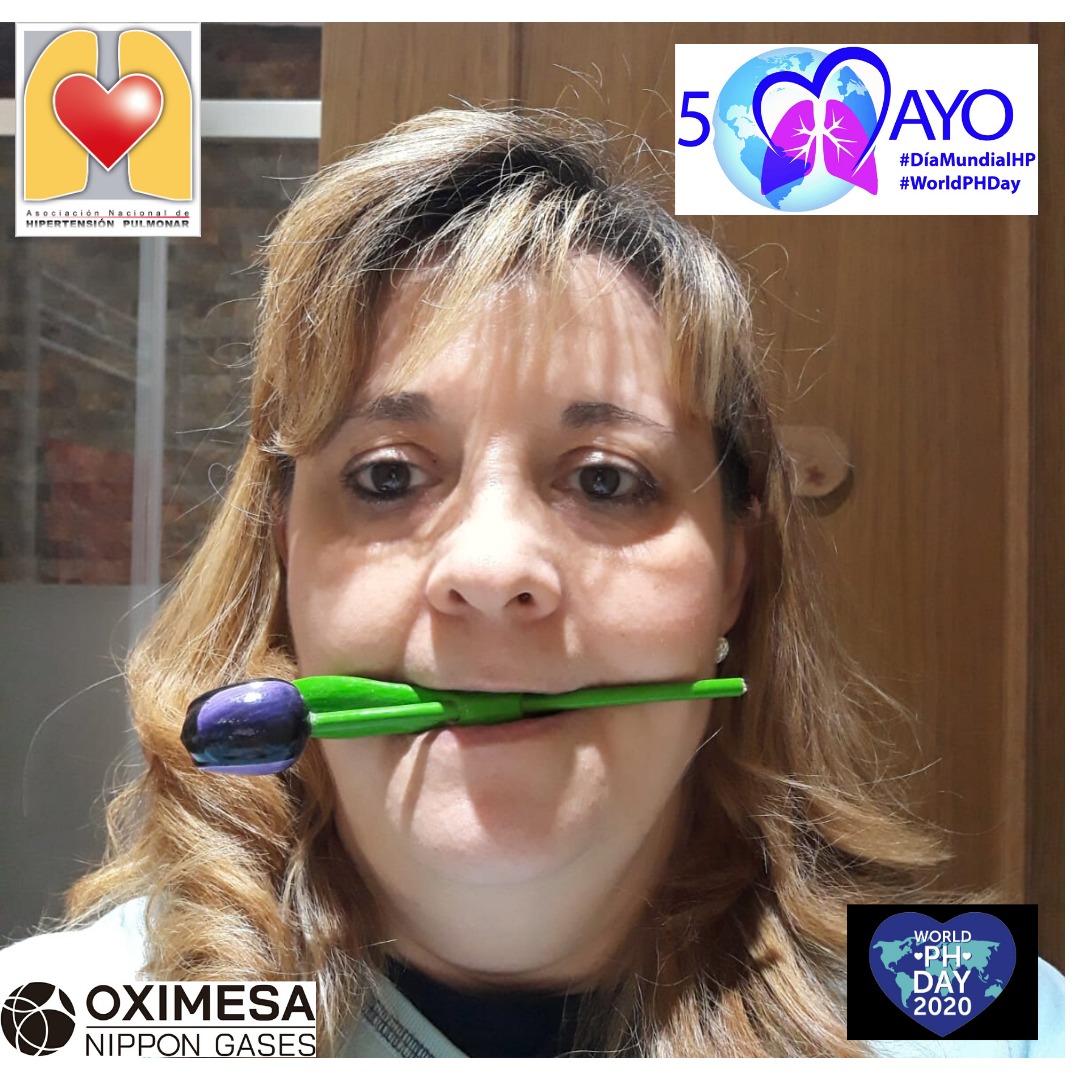 ANdHP's tweet photo. Más personas se unen a la causa! Muchas gracias por poner voz a las personas con #HipertensionPulmonar #DMHipertensionPulmonar #WorldPHDay #WorldPHDay2020 #LabiosAzules #bluelips #pheurope @OximesaNG https://t.co/ny4pmqCGuM