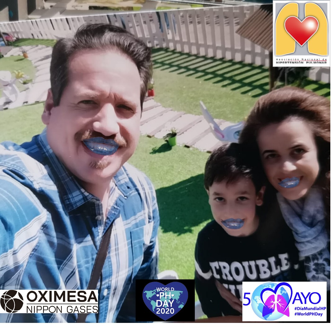 ANdHP's tweet photo. La #HipertensionPulmonar afecta a niños y adultos, a mujeres y a hombres. Píntate los #LabiosAzules #bluelips en #Familia y colabora con la @ANdHP #HipertensionPulmonar #DMHipertensionPulmonar #WorldPHDay #WorldPHDay2020 #pheurope @OximesaNG https://t.co/iD3ngrveBO
