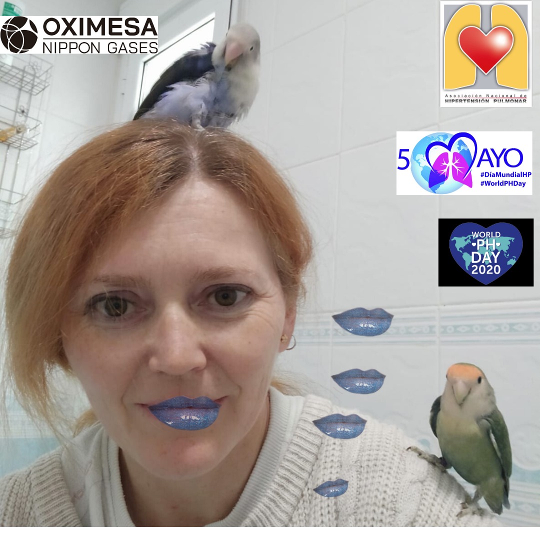 ANdHP's tweet photo. La cianosis, que se te pongan los #LabiosAzules #bluelips es uno de los #síntomas de la #HipertensionPulmonar por ello te animamos a pintarte los labios y a subir la foto hoy que es el #DMHipertensionPulmonar #WorldPHDay #WorldPHDay2020 #pheurope @OximesaNG https://t.co/QFqAzyRpXV
