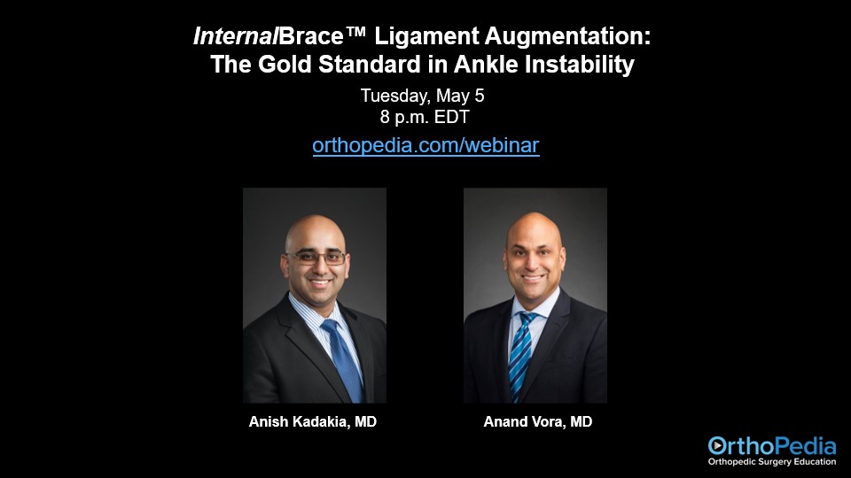 ArthrexMedEd's tweet image. Tonight at 8 p.m. EDT: Hear foot and ankle surgeons discuss the InternalBrace™ ligament augmentation system for treatment of ankle instability. arthrex.info/WEBINAR-050520… #ankleinstability #continuouslearning