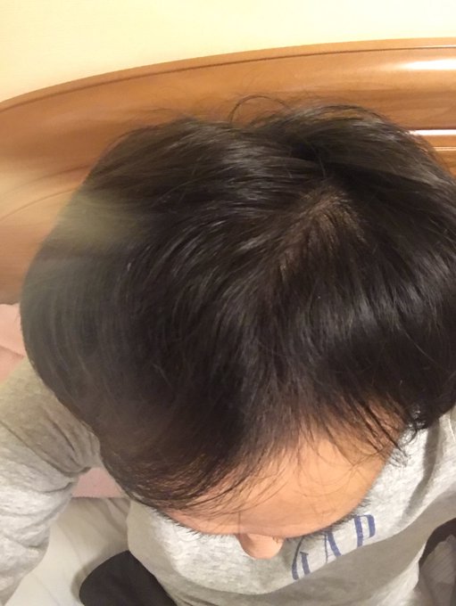 コロナ抜け毛のtwitterイラスト検索結果