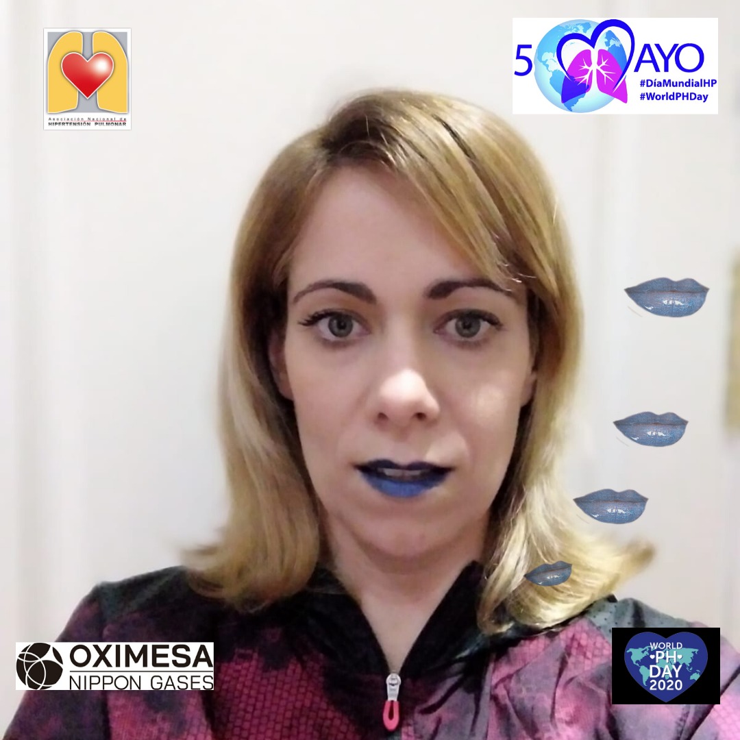 ANdHP's tweet photo. Hoy 5 de mayo celebramos el #DMHipertensionPulmonar y de que mejor forma que compartiendo una foto con los #LabiosAzules #bluelips para nuestra campaña! #WorldPHDay, #WorldPHDay2020 #pheurope @OximesaNG https://t.co/6EMZiWjbK2