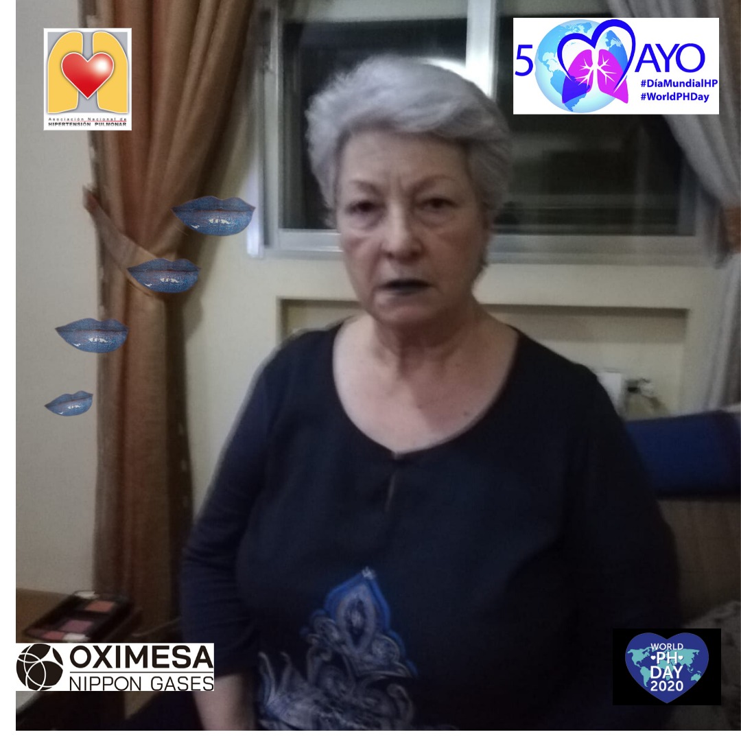 ANdHP's tweet photo. Hoy 5 de mayo celebramos el #DMHipertensionPulmonar y de que mejor forma que compartiendo una foto con los #LabiosAzules #bluelips para nuestra campaña! #WorldPHDay, #WorldPHDay2020 #pheurope @OximesaNG https://t.co/6EMZiWjbK2