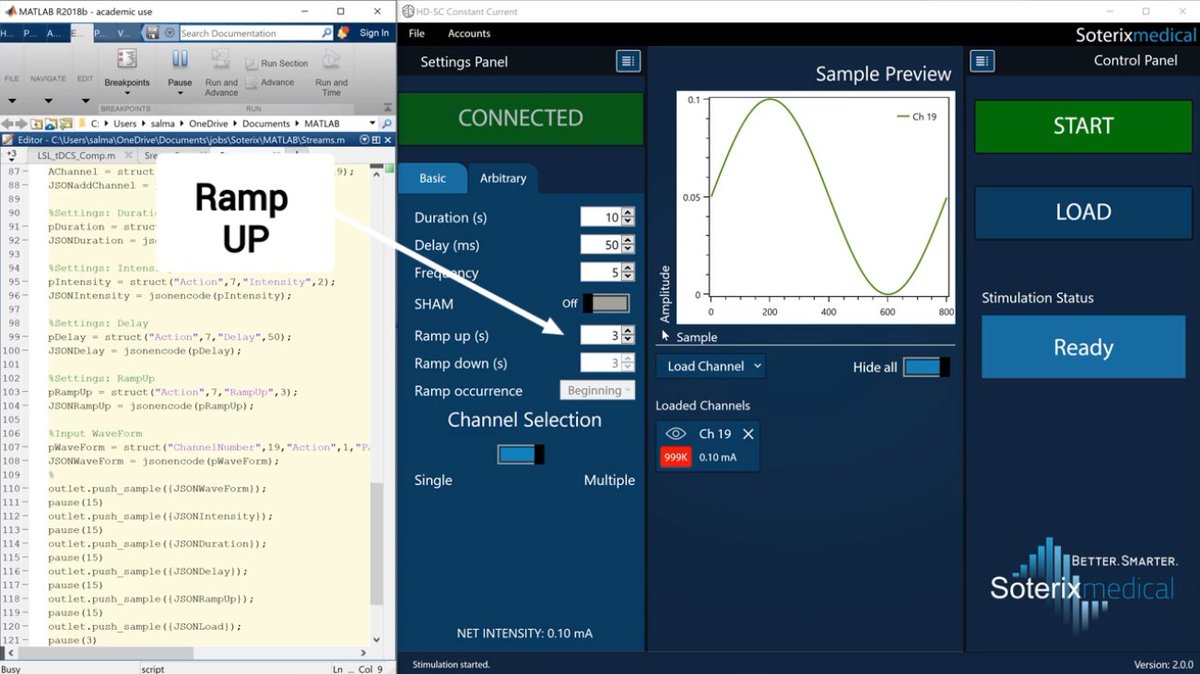 SoterixMedical's tweet photo. Wondering how to plan real time closed-loop tES / tDCS experiments in combination with EEG? MATLAB in combination with LSL allows full control all MXN-33 stimulation settings making it easy https://t.co/NDOT5jagyi #HDtDCS #HDtACS #brainstim #neuromodulation #EEG #closedloop https://t.co/4T8MG4ybC2