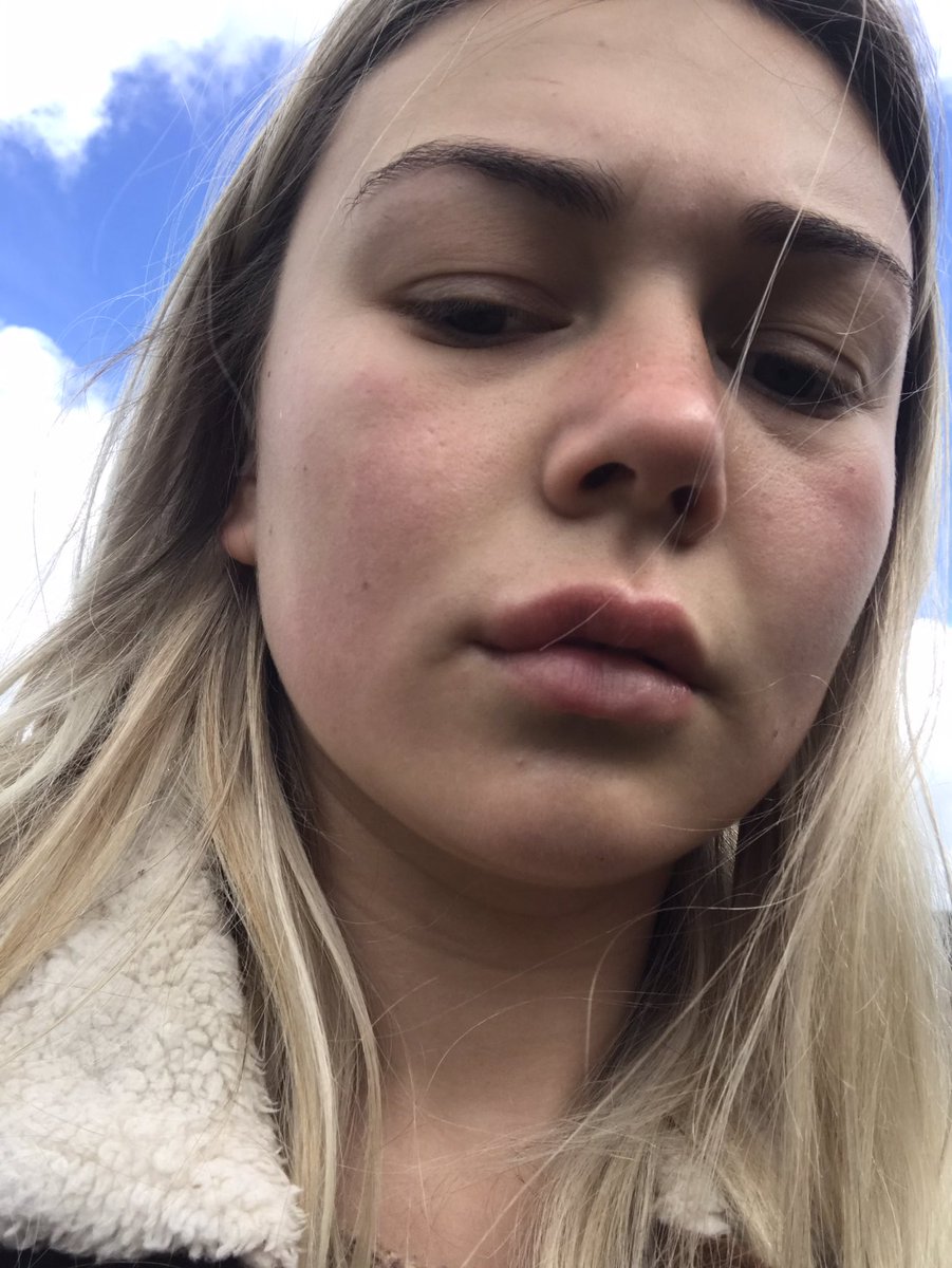 nicolexbruce's tweet photo. @aneisa_hockley I thought it just looked like this like when it first started rhen the next minute https://t.co/UfINMR5qRJ