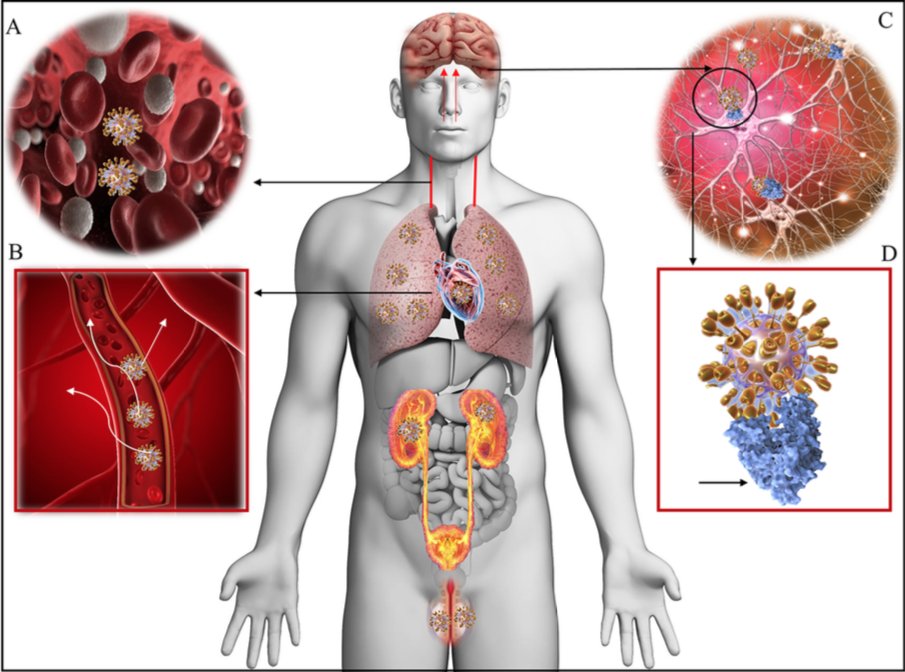interneurona's tweet photo. Hay hipótesis, basadas en estudios de SARS-Cov “1” y MERS. Coronavirus tienen potencial de ingresar al SNC:podrían provocar daño directo o gatillar respuesta (inflamatoria?) capaz de provocar injuria en cerebro/médula/nervios
👉https://t.co/PENjqWMmkV
👉https://t.co/4tRlSGrJtx https://t.co/aEct8Y7guj