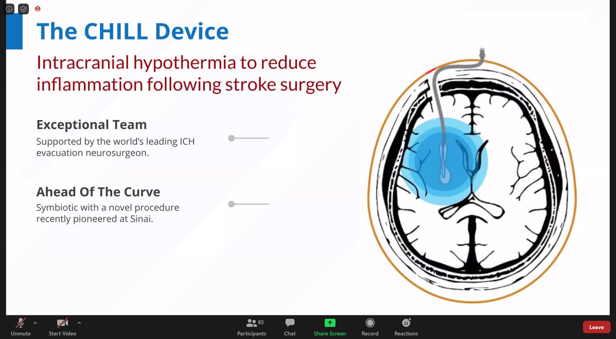 MountSinai_IP's tweet photo. The CHILL team is presenting a post-brain surgery cooling #device to reduce #inflammation and perihematomal edema in #patients. #innovationexchange. @IcahnMountSinai @MountSinaiNeuro https://t.co/Z9nCN3krFP