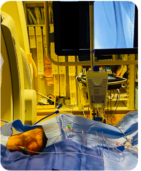 nucryo's tweet photo. Great case by @JohnDavidCorl in treating peripheral arterial disease (PAD) with the PolarCath system from @nucryo.    As peripheral elective procedures are now being allowed across the country, @nucryo is an excellent option to treat PAD!   #safe #data #patient #costsavings https://t.co/muqGfZy6hB