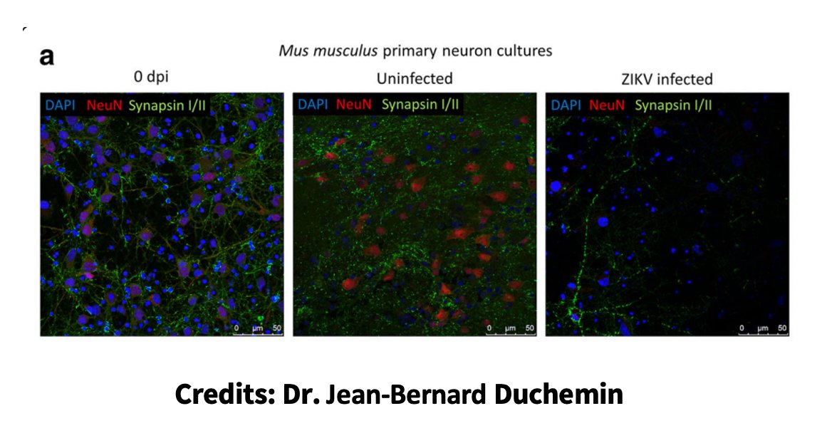mxwbio's tweet image. Did you know that #microelectrodearray technology can be used to study #viruses? @NeuroVino @prasadnp et al. from @CSIRO and @iisrideakin investigated the mechanism of #neurons infection by #Zika with MEA. More about it in our monthly Must-Reads: buff.ly/2zmabue #MxWReads