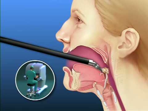 ENTcongress's tweet photo. According to research, laryngeal damage may occur due to prolonged endotracheal intubation, with stridor being the most relevant clinical symptom.

Share your thoughts at https://t.co/FmGMFv1A2o

#entconference #entupdate #entresearchers #doctorsmeet #rhinoplasty #earnosethroat https://t.co/krenzQRHgg