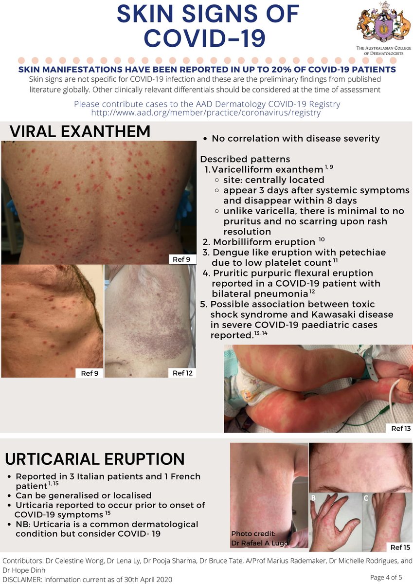 Skin Signs of COVID-19” - Fellows of the ACD have gone through the recent literature and have put together summary of skin findings associated with COVID-19.