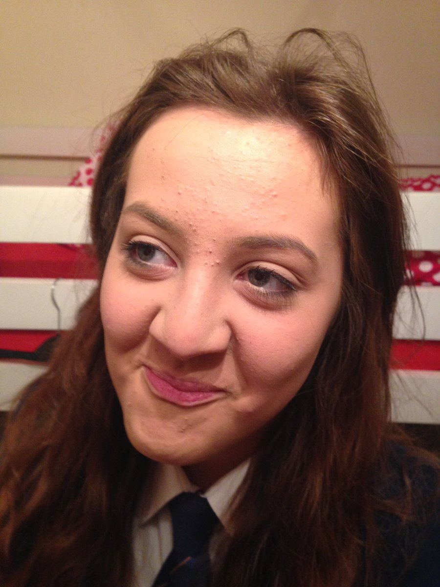 RPD Bear tweet media