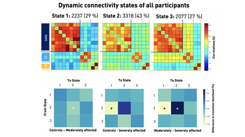 Brain1878's tweet photo. Bonkhoff et al. use dynamic functional connectivity analyses to study changes in network connectivity post-stroke with high temporal resolution. https://t.co/CcF9hJy305 https://t.co/re617cqGBA