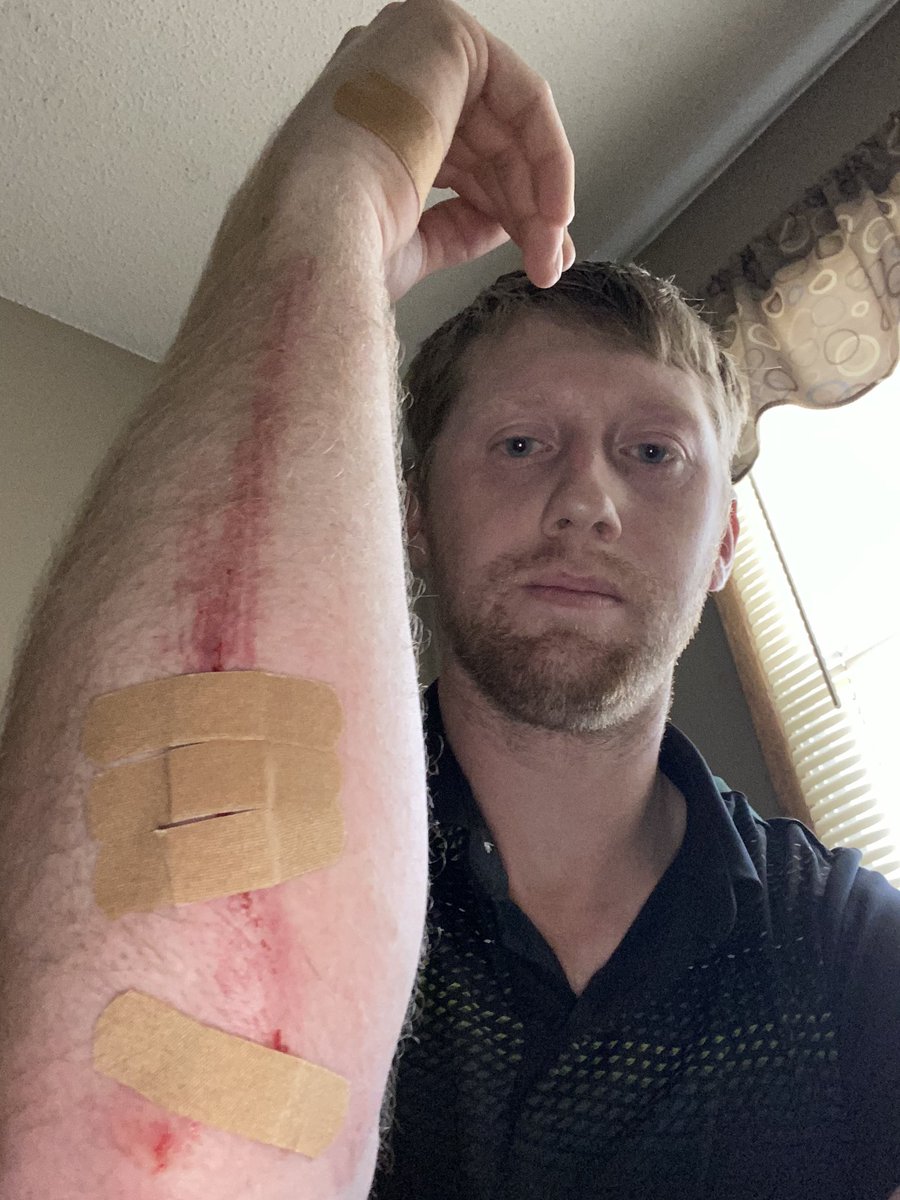 MrLobdell's tweet photo. Ate pavement on my run this morning. Wow! #yikes #learn2run https://t.co/LWMK76hx7X