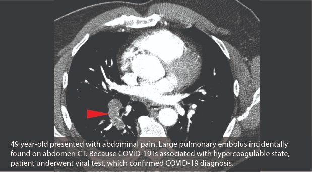 InterventionalRadCO tweet media