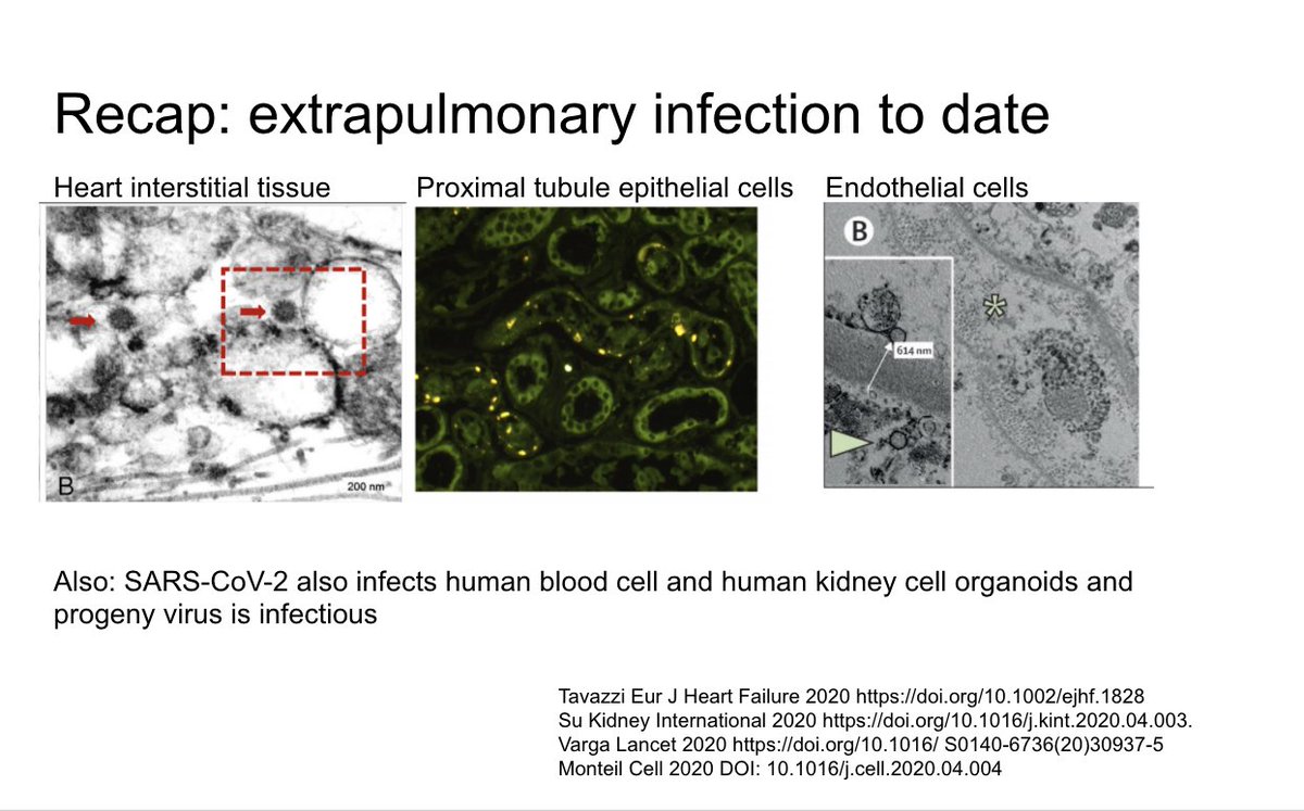 There is accumulating evidence of extrapulmonary infection including papers we have reviewed before summarized in this slide