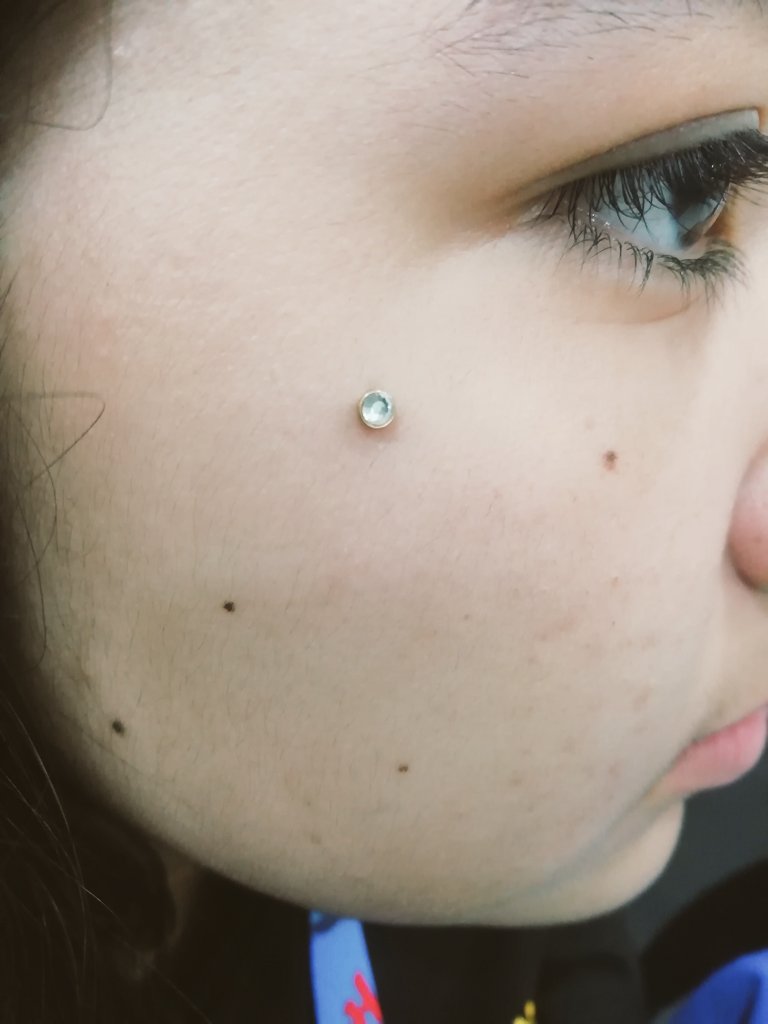piercingmxli's tweet photo. Microdermal o anchord dermal  #mxlipiercing #cultureinked #microdermal #piercing #piercings https://t.co/fKzDwt0gmZ