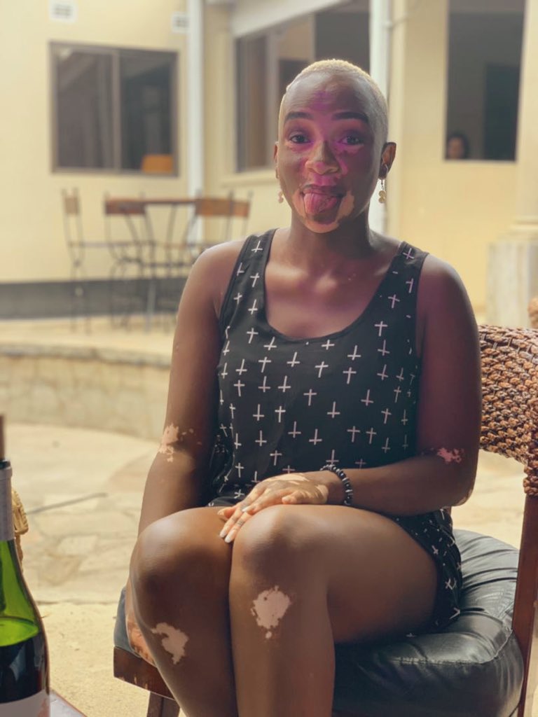 MugabeRumbidzai's tweet photo. War is never friendly, or unsure, don’t go to war unless you are sure you don’t mind destroying something until it is no more.
#vitiligorocks #yummymummy #thesegenesaintnojoke #choconilla #blaquexellence #blackgirlmagic #blackgirlsrock #blackgold #vitiligo https://t.co/hYXP8SDlRT